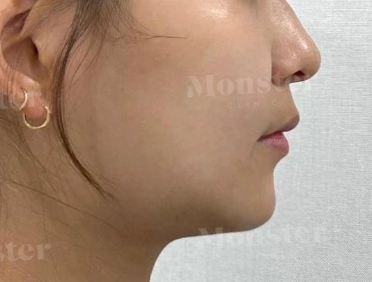 before_image