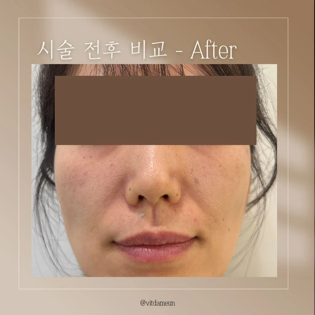before_image