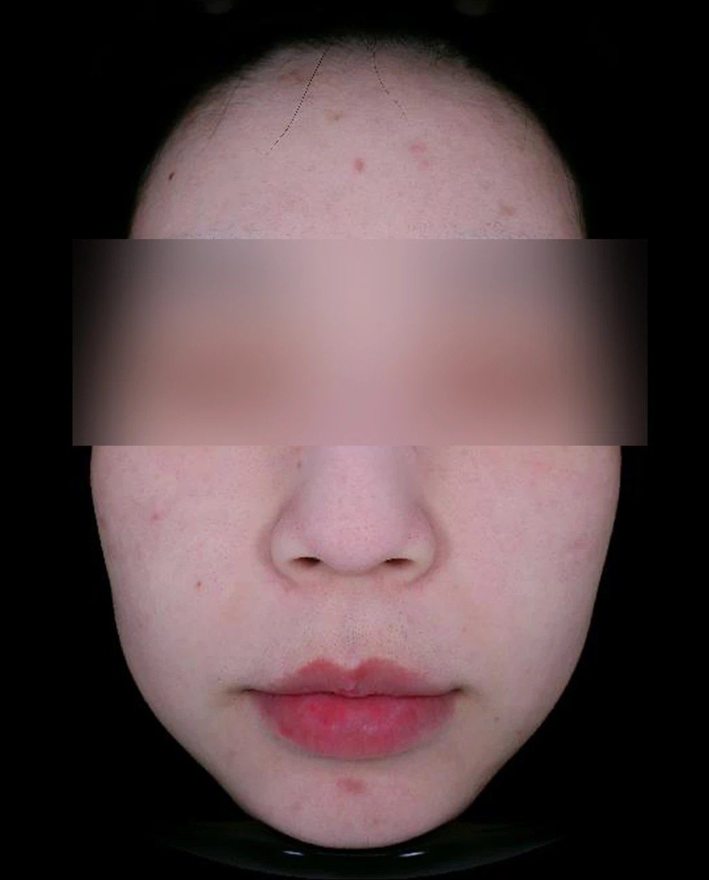 before_image