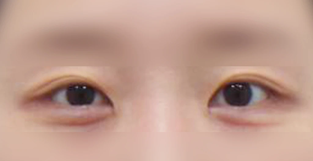 before_image