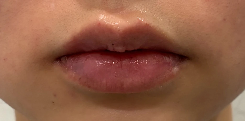 before_image