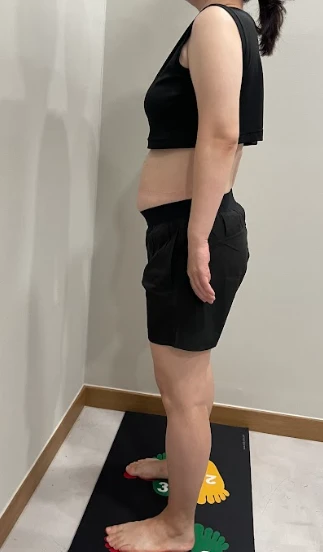 before_image