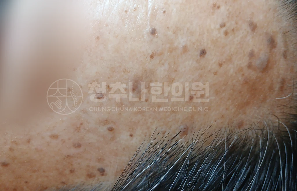 before_image