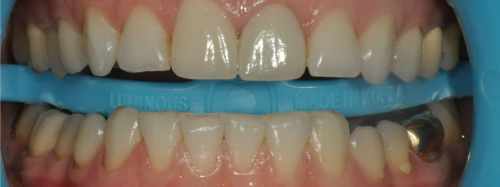 before_image