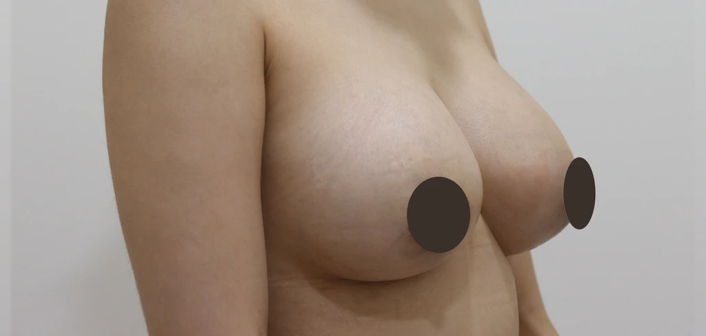 before_image