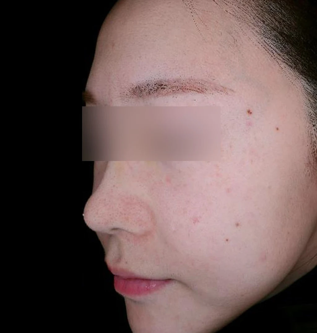 before_image