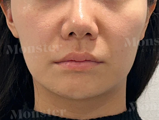 before_image