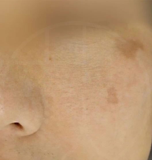 before_image