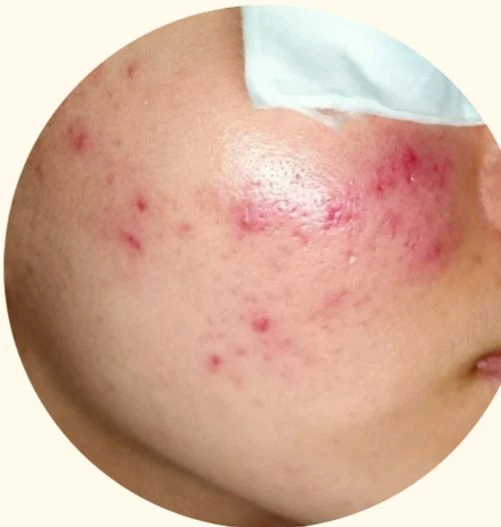 before_image