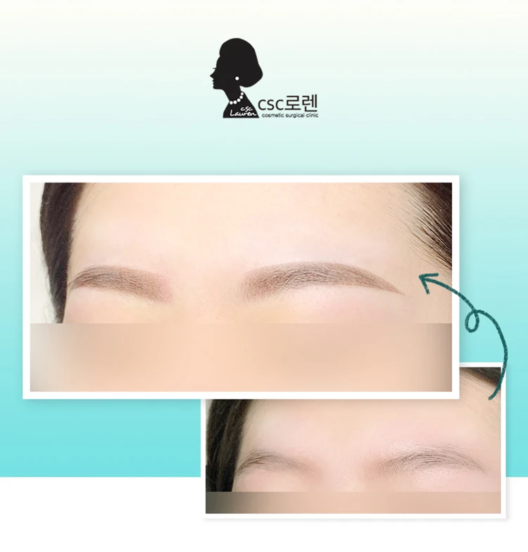 before_image
