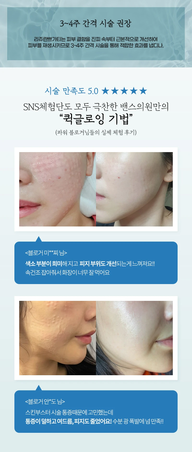 before_image