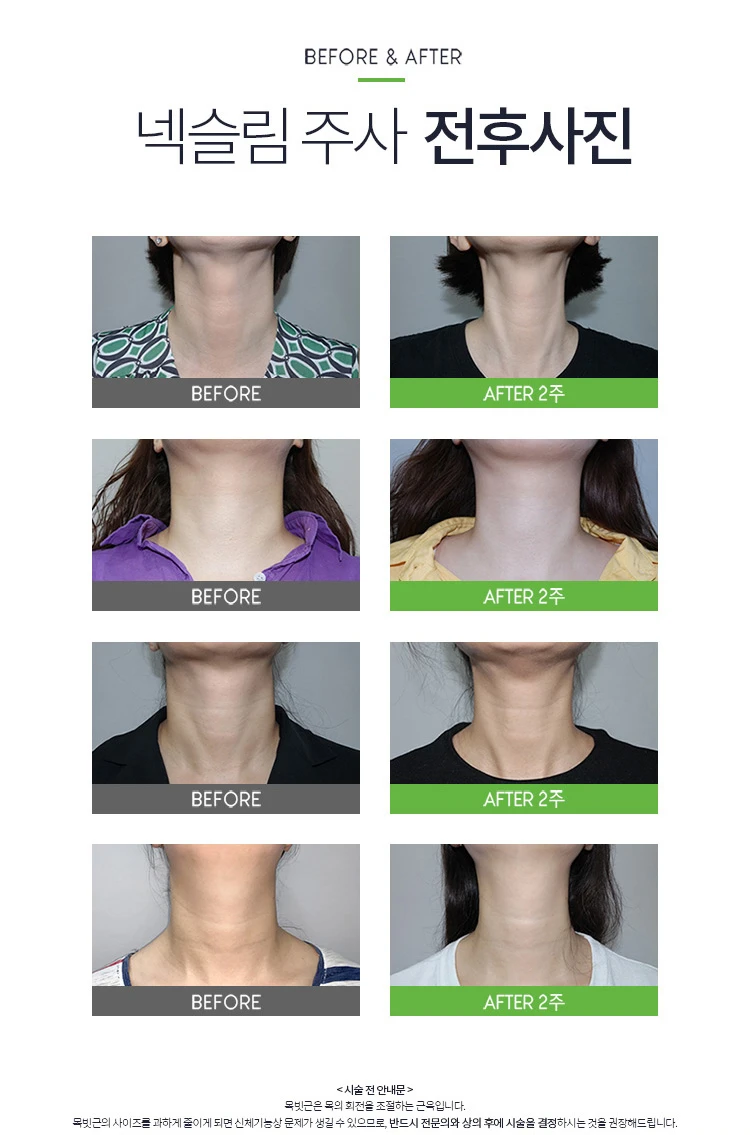 before_image
