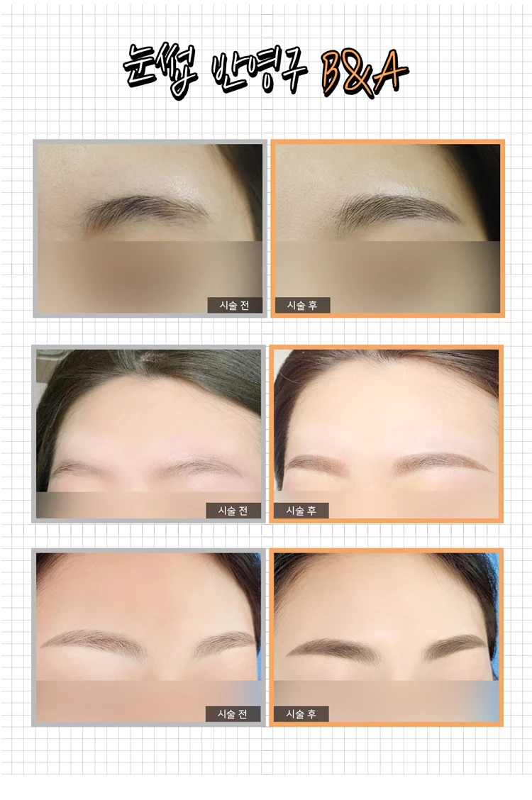 before_image