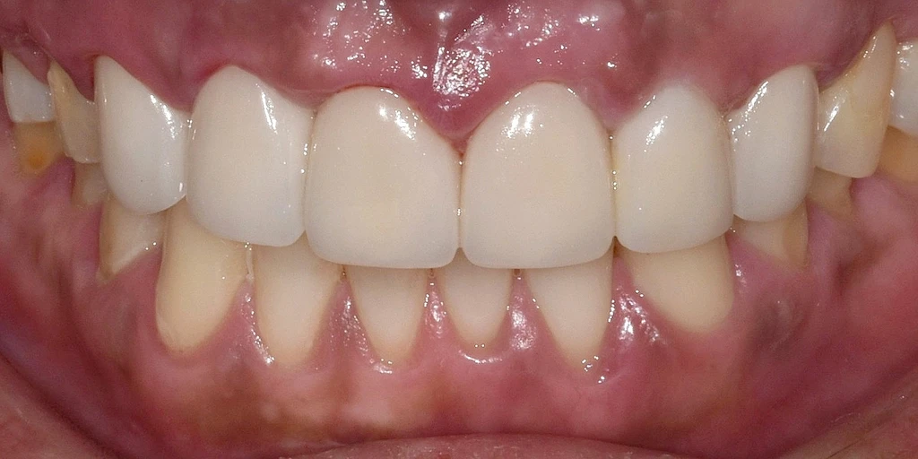 before_image