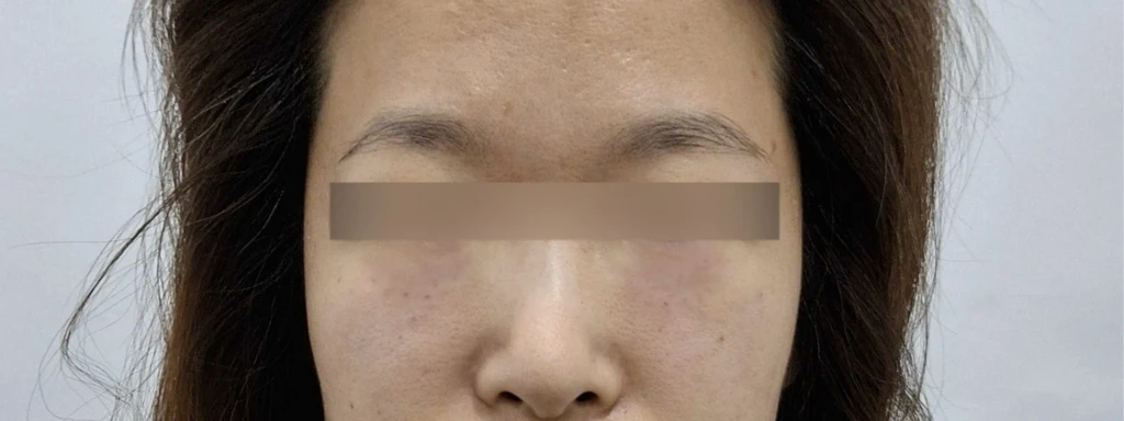 before_image