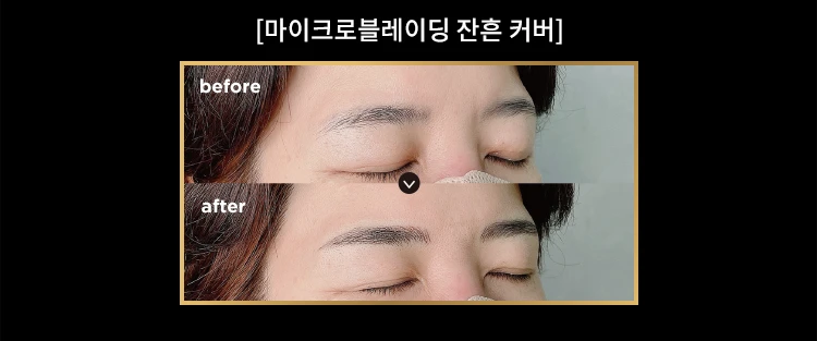 before_image