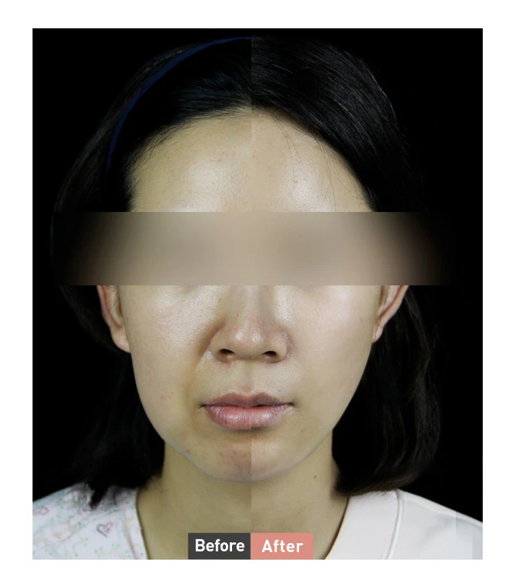 before_image