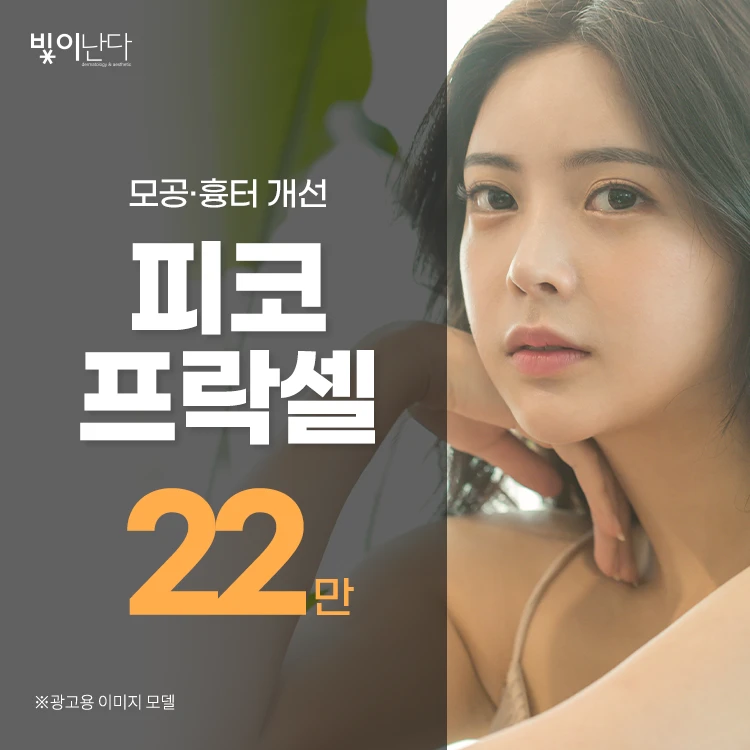 event thumbnail image