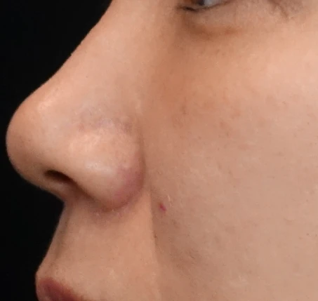 before_image