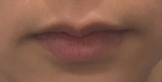 before_image