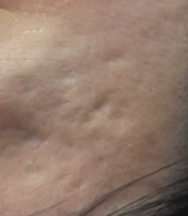 before_image