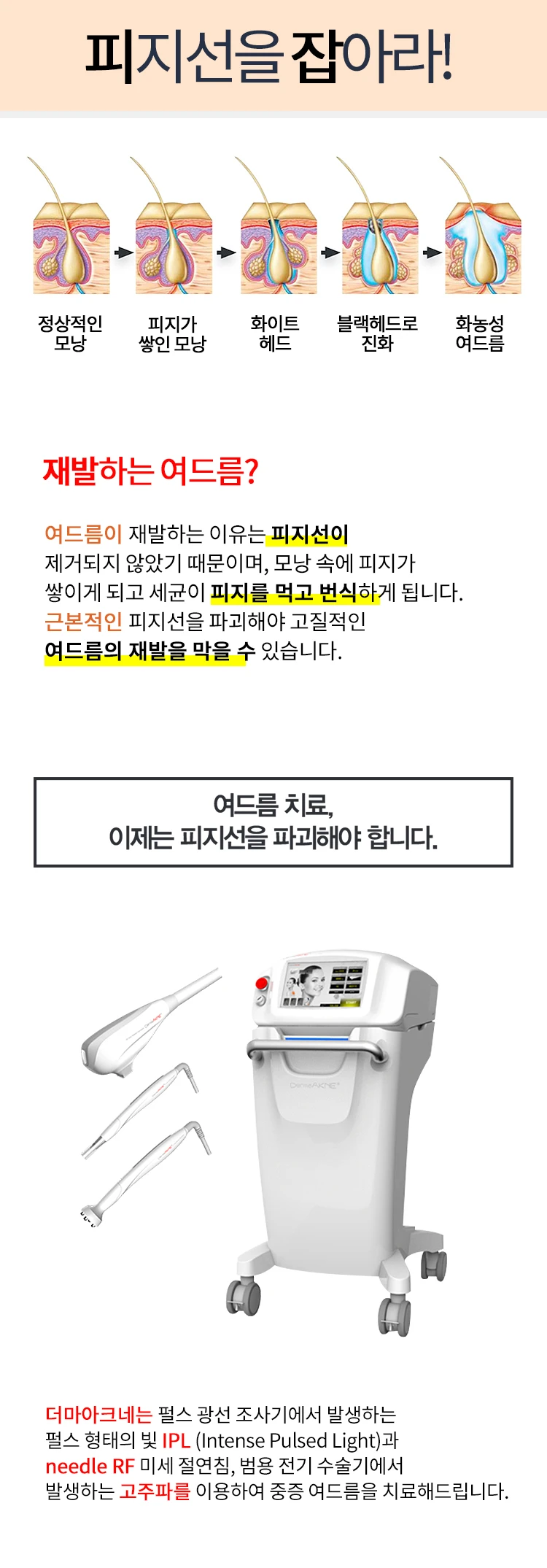 treatmentIntroduction