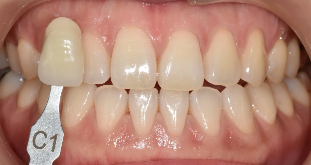 before_image