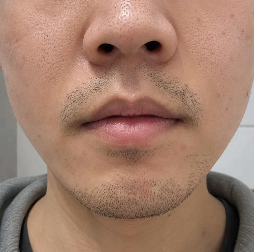 before_image