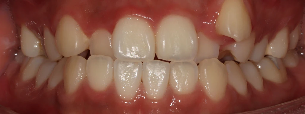 before_image