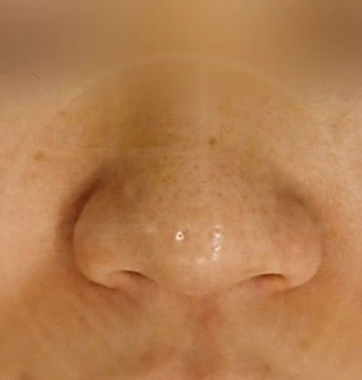 before_image
