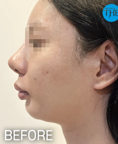 before_image