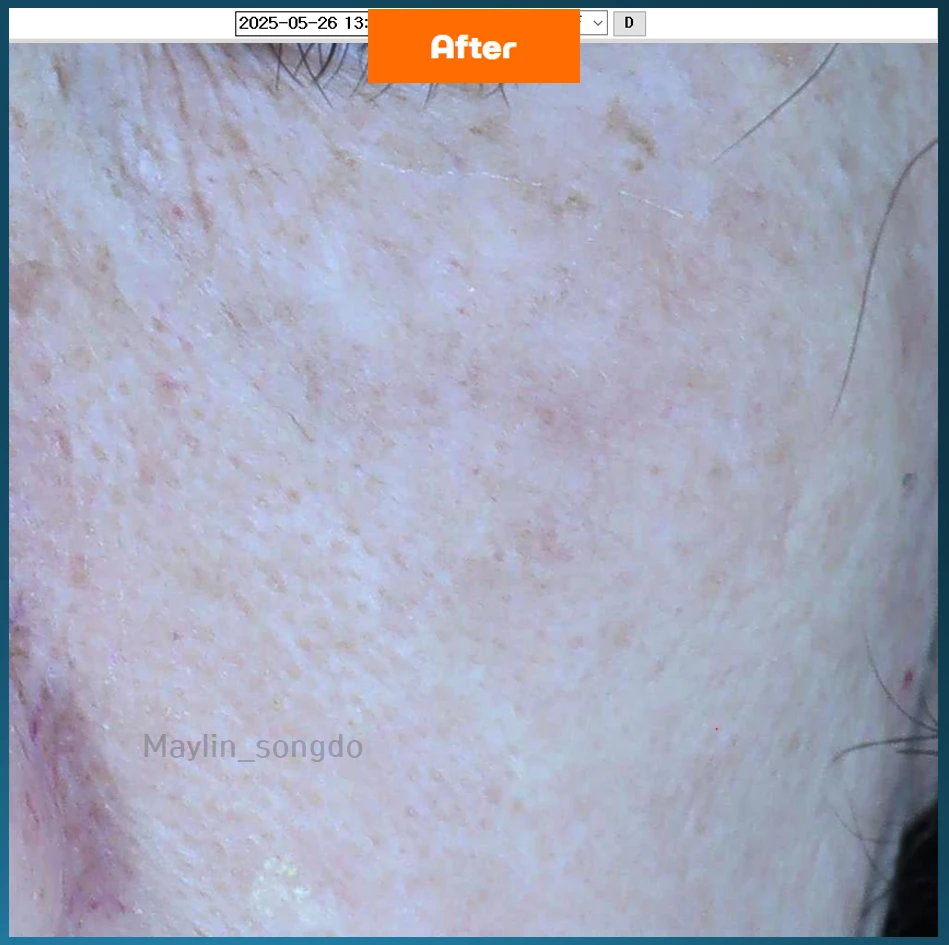 before_image