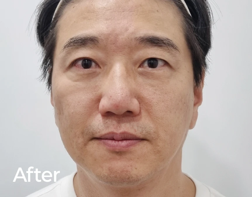 before_image