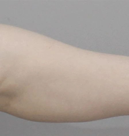 before_image