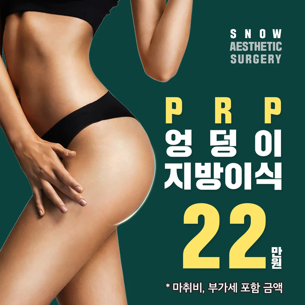 event thumbnail image