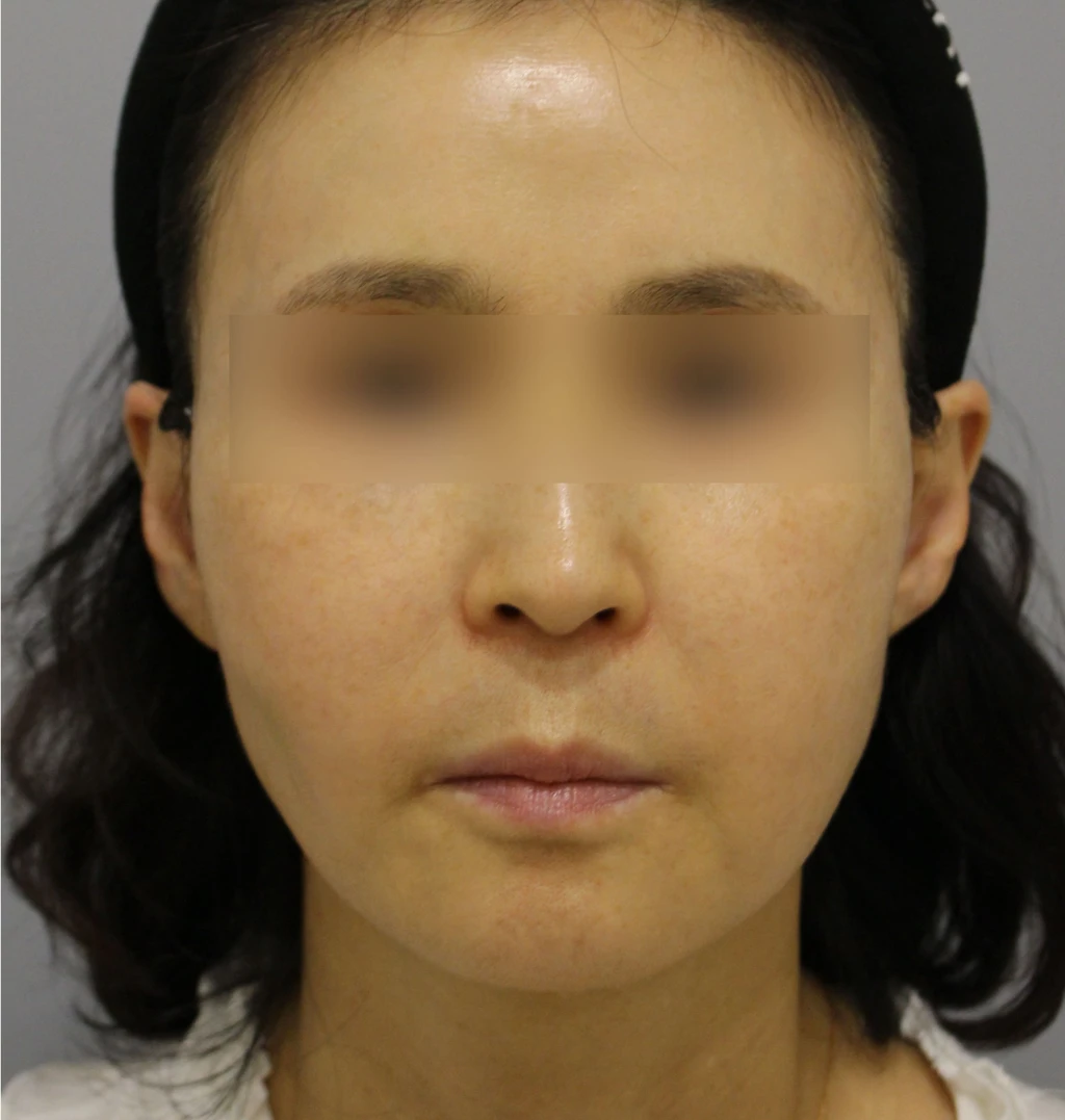 before_image