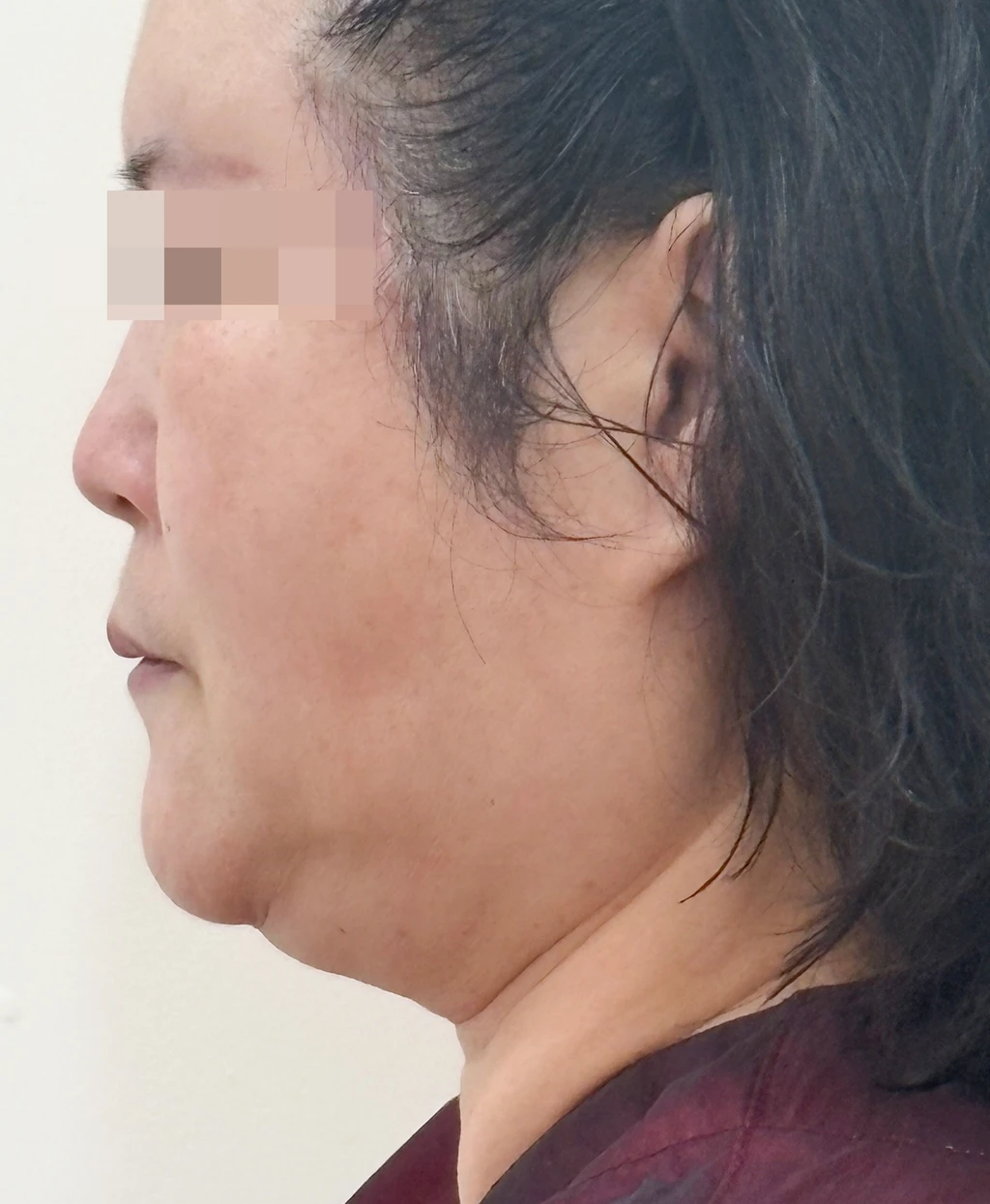 before_image