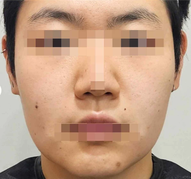 before_image