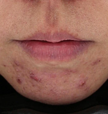 before_image