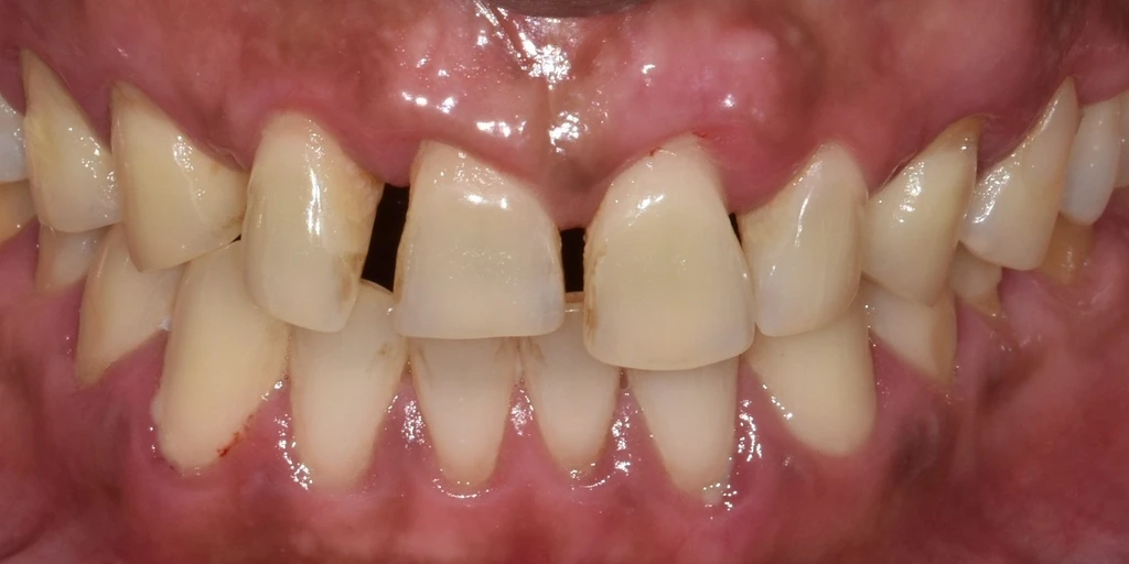 before_image