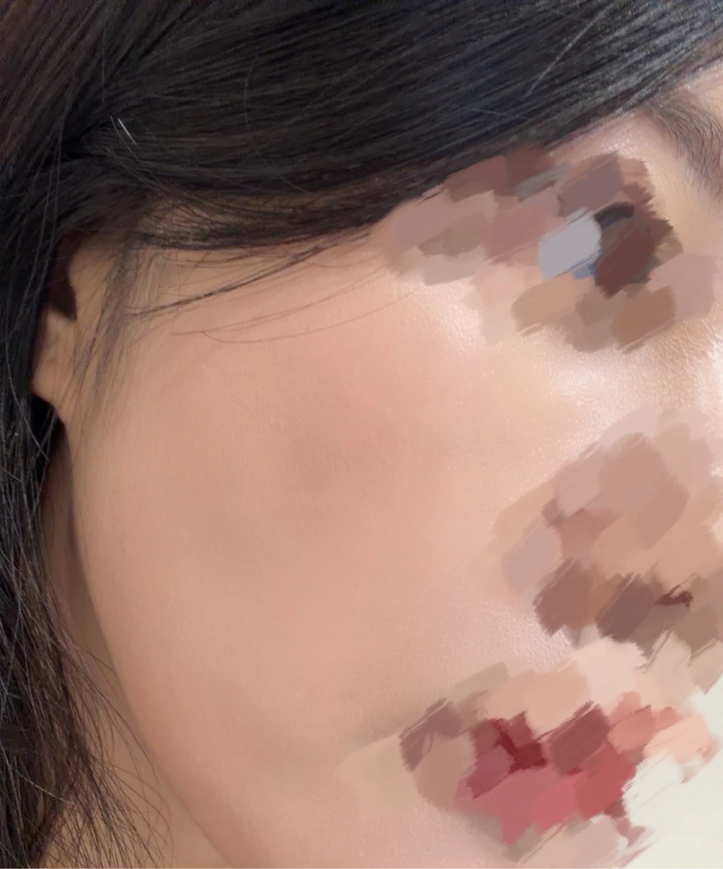 before_image
