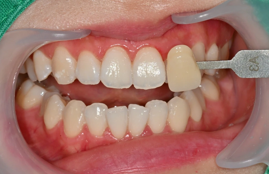 before_image