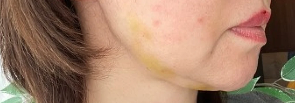 before_image
