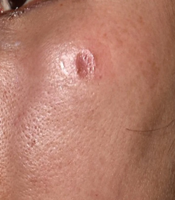 before_image
