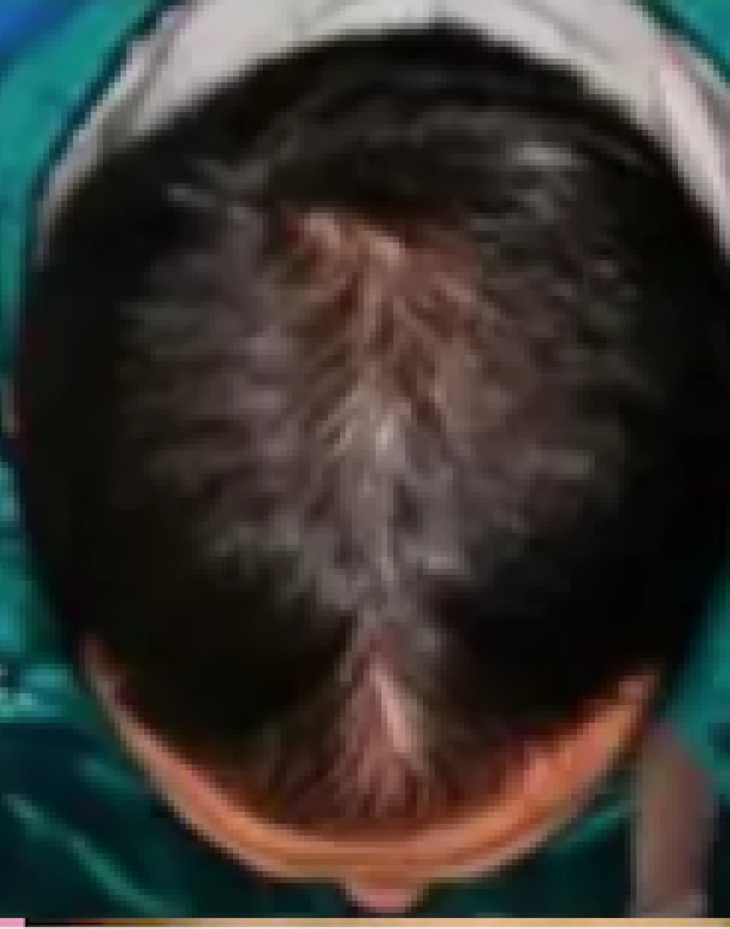 before_image