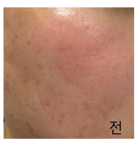 before_image