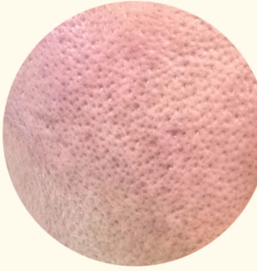 before_image