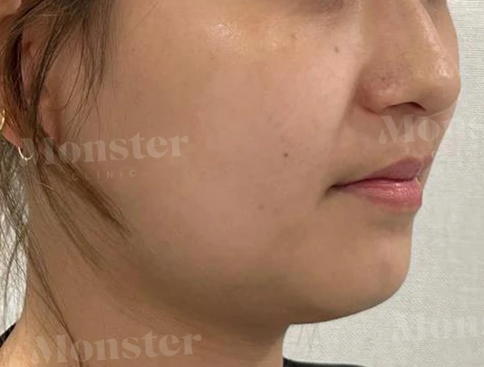 before_image