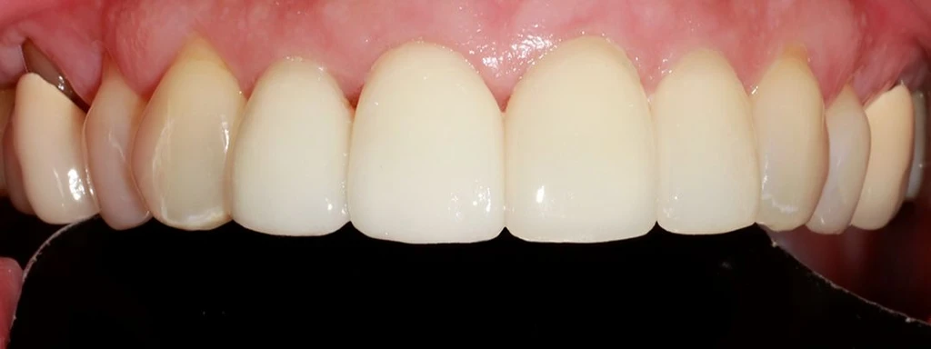 before_image
