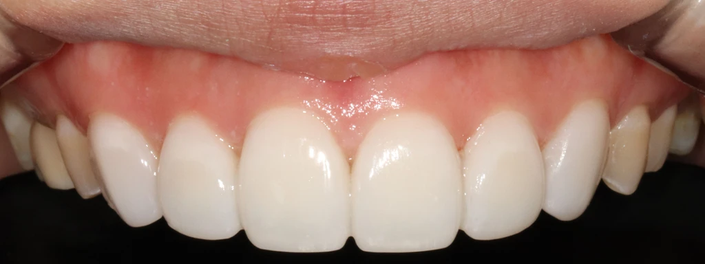 before_image